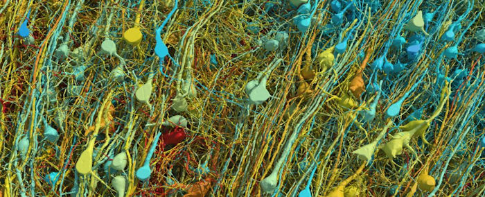 brain 3d